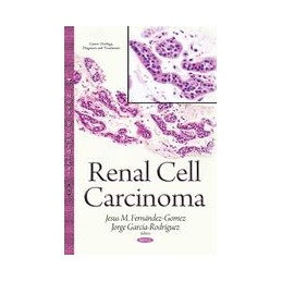 Renal Cell Carcinoma