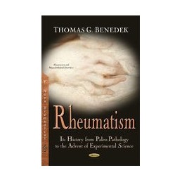 Rheumatism: Its History...