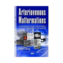 Arteriovenous Malformations: A Comprehensive Guide to Natural History, Diagnosis & Management