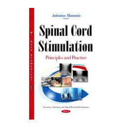 Spinal Cord Stimulation:...