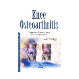 Knee Osteoarthritis:...