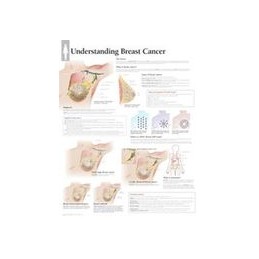 Understanding Breast Cancer...