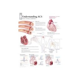 Understanding ACS (Acute...