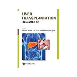 Liver Transplantation:...