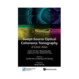 Swept-source Optical...