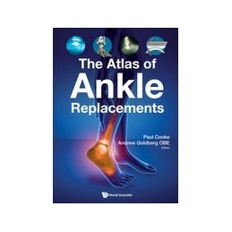 Atlas Of Ankle Replacements