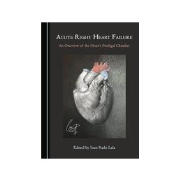 Acute Right Heart Failure: An Overview of the Heart's Prodigal Chamber