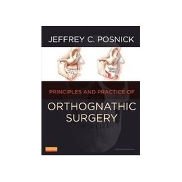 Orthognathic Surgery - 2 Volume Set