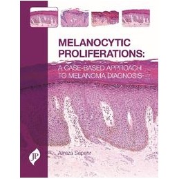 Melanocytic Proliferations: A Case-Based Approach to Melanoma Diagnosis