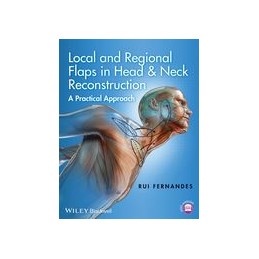 Local and Regional Flaps in Head and Neck Reconstruction: A Practical Approach