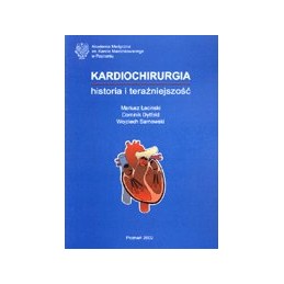 Kardiochirurgia - historia...