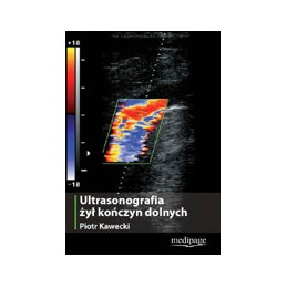 Ultrasonografia żył kończyn...