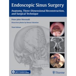 Endoscopic Sinus Surgery:...