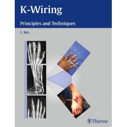 K-Wiring: Principles and...