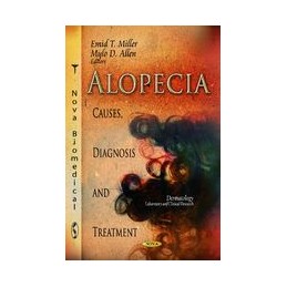 Alopecia: Causes, Diagnosis...