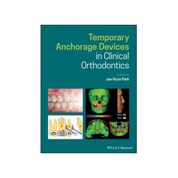 Temporary Anchorage Devices in Clinical Orthodontics
