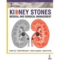 Kidney Stones: Medical and Surgical Management