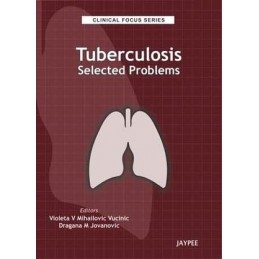 Clinical Focus Series: Tuberculosis: Selected Problems