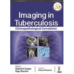 Imaging in Tuberculosis: Clinicopathological Correlation