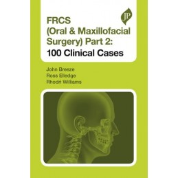 FRCS (Oral & Maxillofacial Surgery) Part 2: 100 Clinical Cases