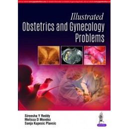 Illustrated Obstetrics and...