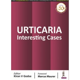 Urticaria: Interesting Cases