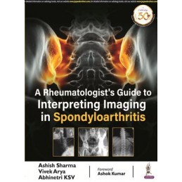 A Rheumatologist's Guide to...