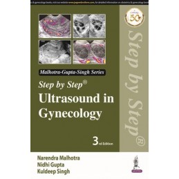 Step by Step Ultrasound in Gynecology