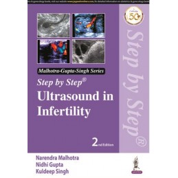 Step by Step Ultrasound in Infertility