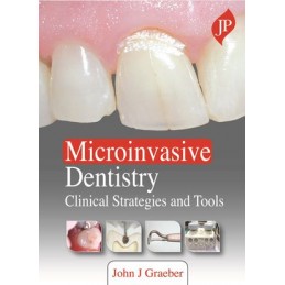 Microinvasive Dentistry: Clinical Strategies and Tools