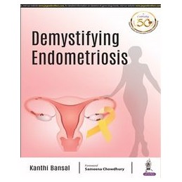 Demystifying Endometriosis