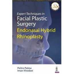 Expert Techniques in Facial Plastic Surgery: Endonasal Hybrid Rhinoplasty
