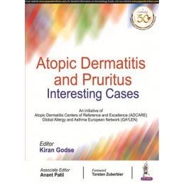 Atopic Dermatitis and Pruritus: Interesting Cases