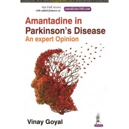 Amantadine in Parkinsons Disease: An Expert Opinion