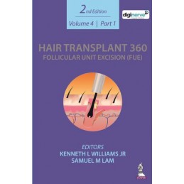 Hair Transplant 360:...