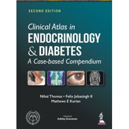 Clinical Atlas in Endocrinology and Diabetes: A Case-based Compendium