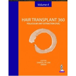 Hair Transplant 360: Volume...