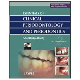 Essentials of Clinical Periodontology and Periodontics