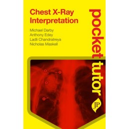 Pocket Tutor Chest X-Ray...