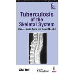 Tuberculosis of the...