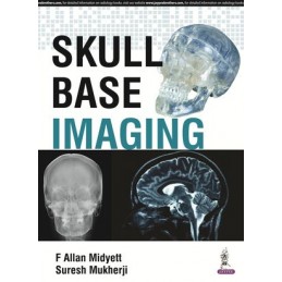 Skull Base Imaging