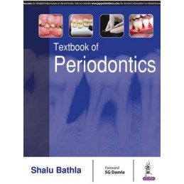 Textbook of Periodontics