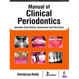 Manual of Clinical Periodontics