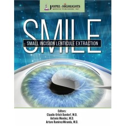 SMILE: Small Incision...