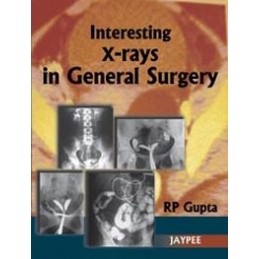 Interesting X-Rays in...