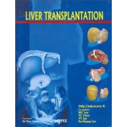 Liver Transplantation