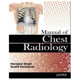Manual of Chest Radiology