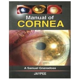 Manual of Cornea