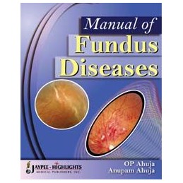 Manual of Fundus Diseases