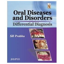 Oral Diseases and Disorders: Differential Diagnosis